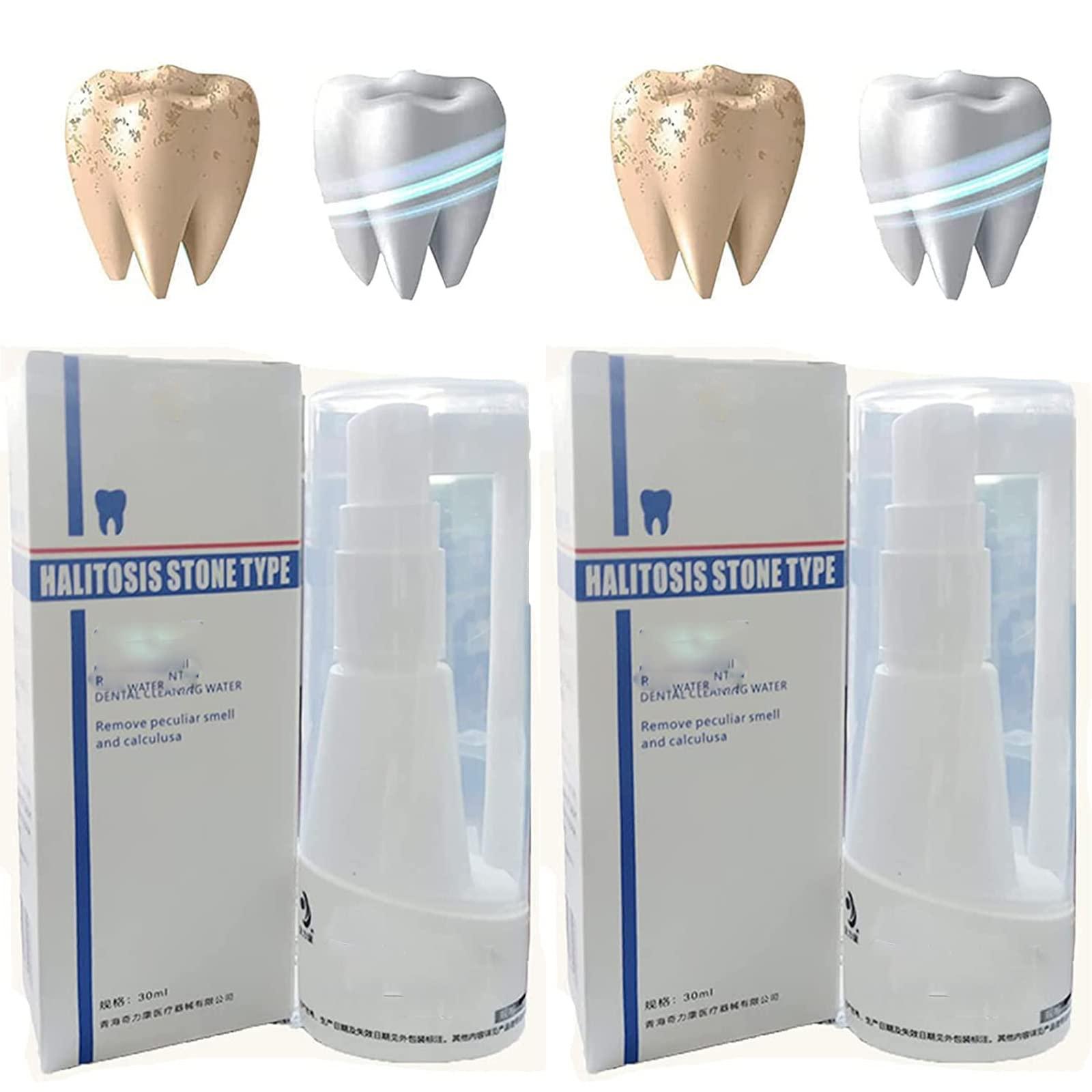 Anshka 30ml Calculusfree Dissolving Dental Spray,Dental Calculus Remover Teeth Cleaner,Mouth Refreshing Spray,Plaque Remover for Teeth Mouthwash,Intensive Stain Removal Toothpaste (2pcs)