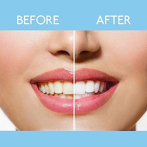 Global Care Market Professional Strength Tooth Polisher & Whitener Removes Teeth Surface Stains and Whitening Teeth