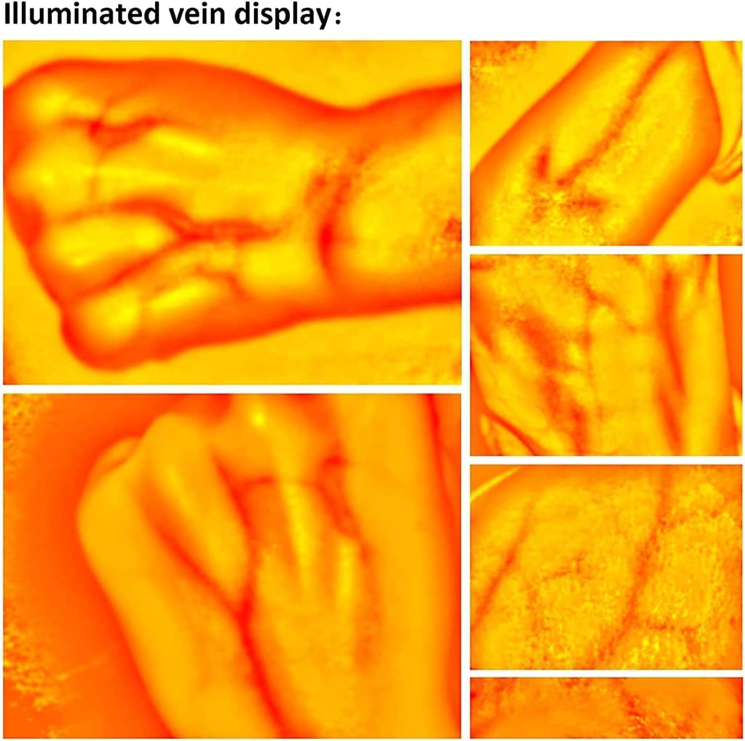 NAKEAH NAKEAH Vein Finder, Medical Vein Viewer Finder Display Machine, Vein Illuminator Device Light, Imaging Vein Finder for Adult and Children