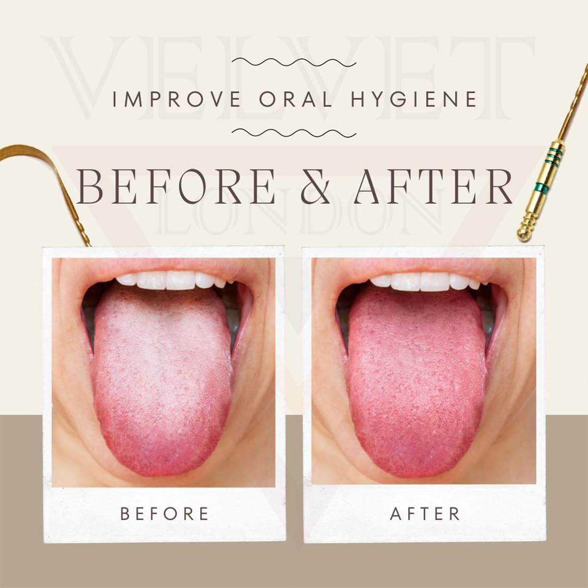 velvet london VELVET LONDON Brass Tongue Scrapers for adults, Grip Handles Tongue Scraper, Dental Care Hygiene Oral Care Ayurvedic Mouth Tongue Cleaner Fresh Breath, U shape (Brass (Pack of 5))